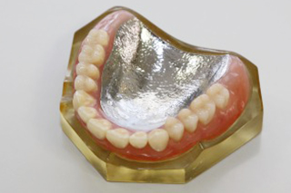 金属床　義歯