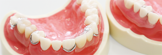 中歯科医院の入れ歯の特徴